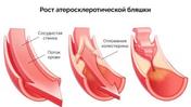 Сосуды